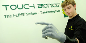 Bionická ruka od Mercedes-Benz